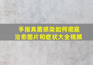 手指真菌感染如何彻底治愈图片和症状大全视频