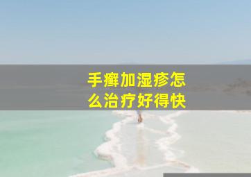 手癣加湿疹怎么治疗好得快