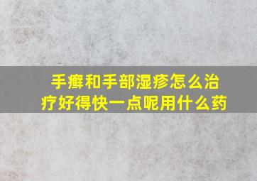 手癣和手部湿疹怎么治疗好得快一点呢用什么药