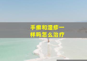 手癣和湿疹一样吗怎么治疗