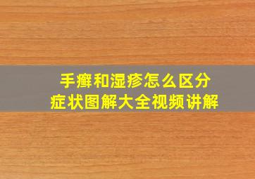 手癣和湿疹怎么区分症状图解大全视频讲解