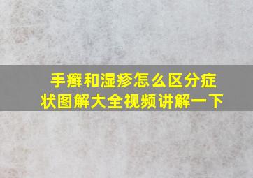 手癣和湿疹怎么区分症状图解大全视频讲解一下