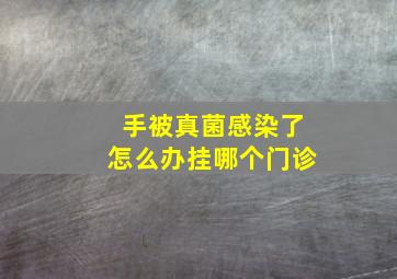 手被真菌感染了怎么办挂哪个门诊