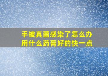 手被真菌感染了怎么办用什么药膏好的快一点