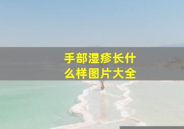 手部湿疹长什么样图片大全