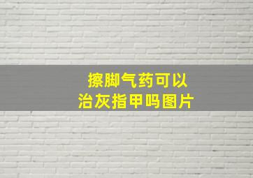 擦脚气药可以治灰指甲吗图片