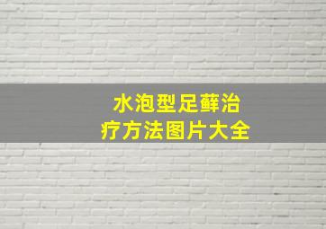 水泡型足藓治疗方法图片大全