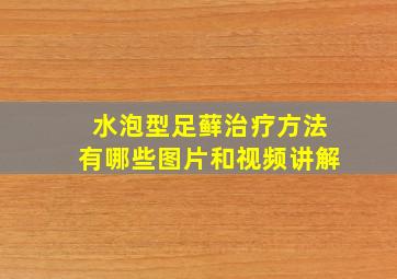 水泡型足藓治疗方法有哪些图片和视频讲解