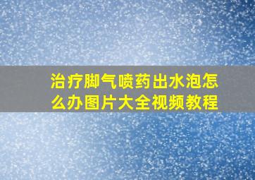 治疗脚气喷药出水泡怎么办图片大全视频教程