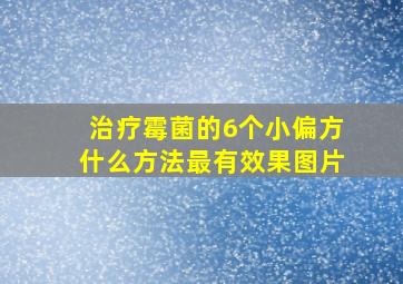 治疗霉菌的6个小偏方什么方法最有效果图片