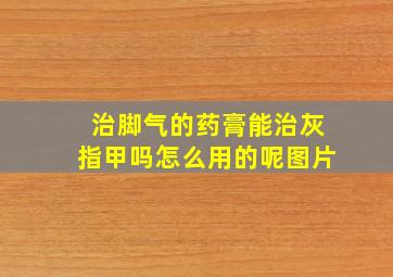 治脚气的药膏能治灰指甲吗怎么用的呢图片