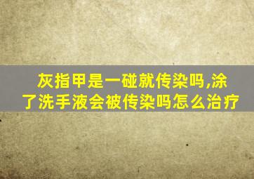 灰指甲是一碰就传染吗,涂了洗手液会被传染吗怎么治疗