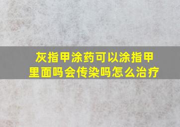 灰指甲涂药可以涂指甲里面吗会传染吗怎么治疗