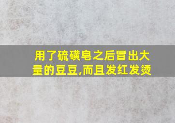 用了硫磺皂之后冒出大量的豆豆,而且发红发烫