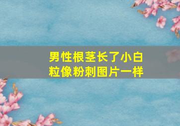 男性根茎长了小白粒像粉刺图片一样