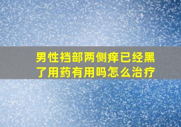 男性裆部两侧痒已经黑了用药有用吗怎么治疗