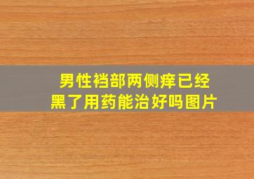 男性裆部两侧痒已经黑了用药能治好吗图片