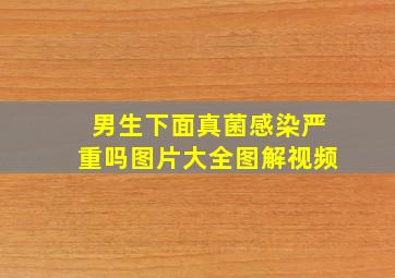 男生下面真菌感染严重吗图片大全图解视频