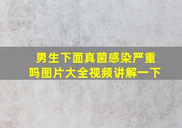 男生下面真菌感染严重吗图片大全视频讲解一下