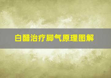 白醋治疗脚气原理图解