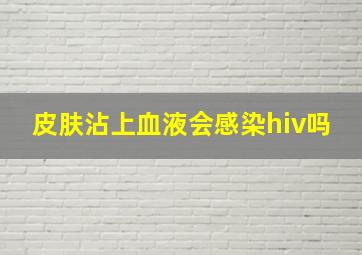 皮肤沾上血液会感染hiv吗