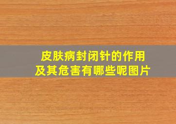 皮肤病封闭针的作用及其危害有哪些呢图片