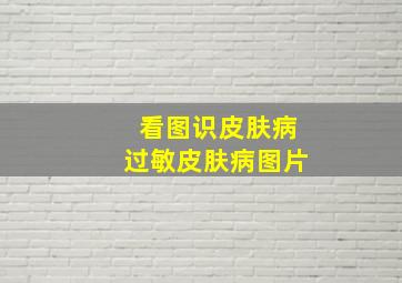 看图识皮肤病过敏皮肤病图片