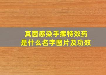 真菌感染手癣特效药是什么名字图片及功效