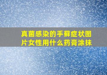 真菌感染的手藓症状图片女性用什么药膏涂抹