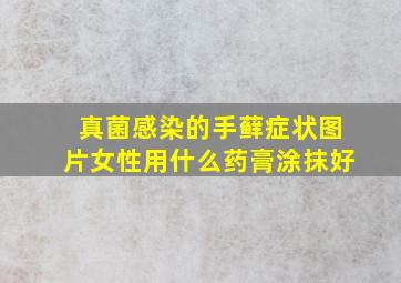 真菌感染的手藓症状图片女性用什么药膏涂抹好