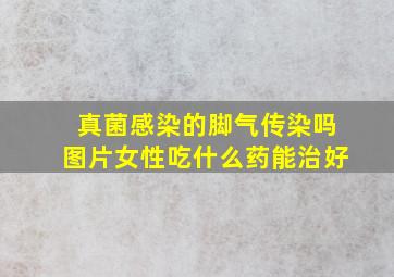 真菌感染的脚气传染吗图片女性吃什么药能治好