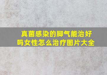 真菌感染的脚气能治好吗女性怎么治疗图片大全