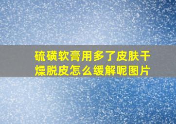 硫磺软膏用多了皮肤干燥脱皮怎么缓解呢图片