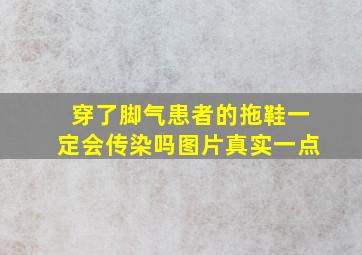 穿了脚气患者的拖鞋一定会传染吗图片真实一点