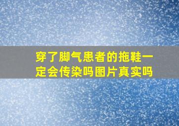 穿了脚气患者的拖鞋一定会传染吗图片真实吗