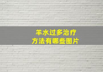 羊水过多治疗方法有哪些图片