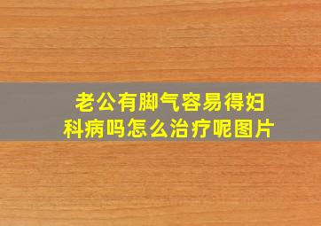 老公有脚气容易得妇科病吗怎么治疗呢图片