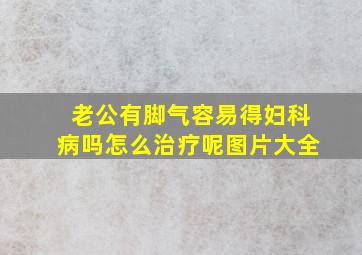 老公有脚气容易得妇科病吗怎么治疗呢图片大全