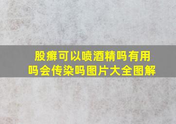 股癣可以喷酒精吗有用吗会传染吗图片大全图解