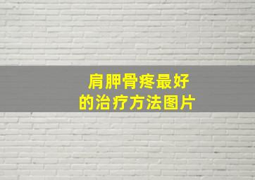 肩胛骨疼最好的治疗方法图片