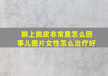 脚上脱皮非常臭怎么回事儿图片女性怎么治疗好