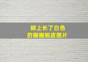 脚上长了白色的圈圈脱皮图片