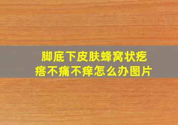 脚底下皮肤蜂窝状疙瘩不痛不痒怎么办图片