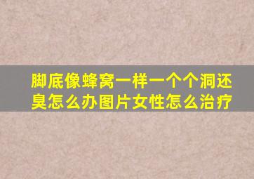 脚底像蜂窝一样一个个洞还臭怎么办图片女性怎么治疗