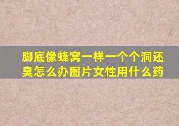 脚底像蜂窝一样一个个洞还臭怎么办图片女性用什么药