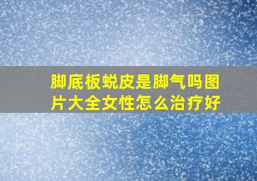 脚底板蜕皮是脚气吗图片大全女性怎么治疗好