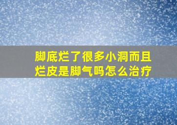 脚底烂了很多小洞而且烂皮是脚气吗怎么治疗