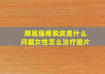 脚底瘙痒脱皮是什么问题女性怎么治疗图片