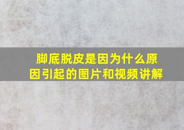 脚底脱皮是因为什么原因引起的图片和视频讲解