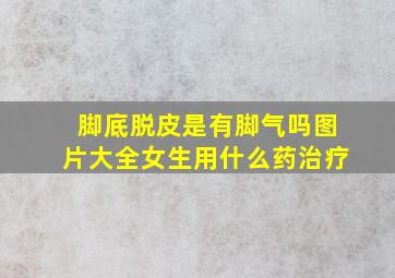 脚底脱皮是有脚气吗图片大全女生用什么药治疗